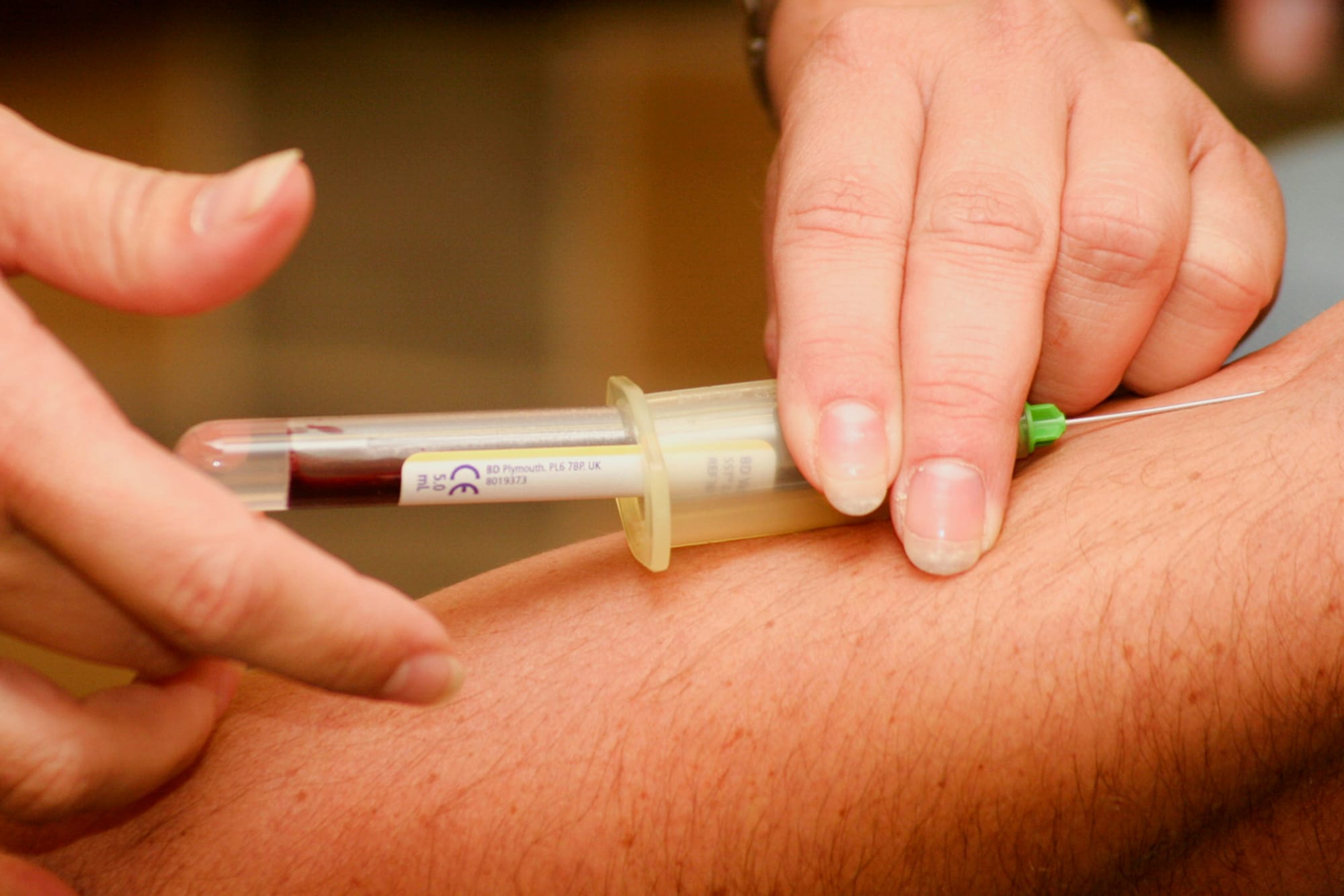Understanding Cholesterol: The Good, The Bad, and The Ugly