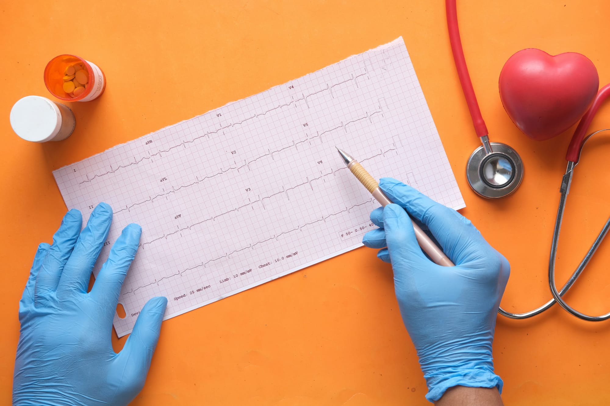 Heart Disease in Young Adults: Understanding the Risks and Prevention