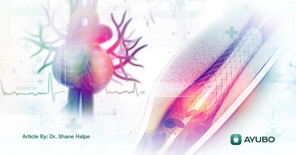 Living Healthy After a Heart Stent: What You Need to Know